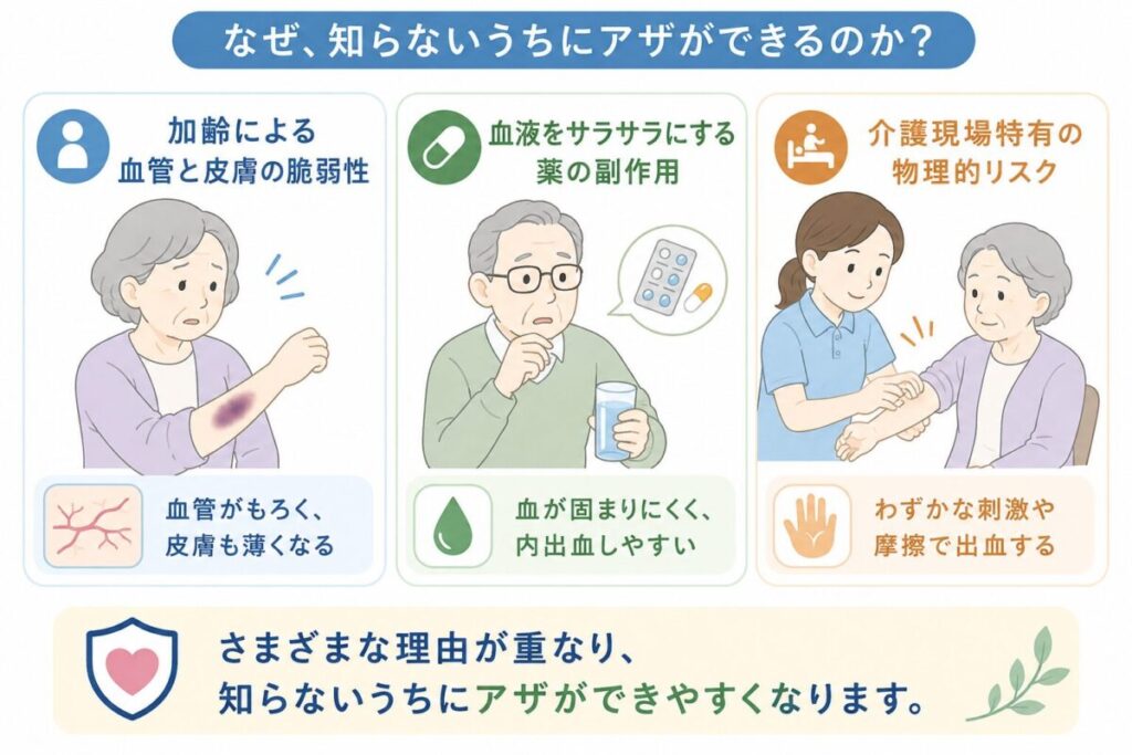 加齢による皮膚や血管の弱さ、血液をサラサラにする薬の影響、介護中の接触や圧迫などが重なり、気づかないうちにアザができる理由を示した図。