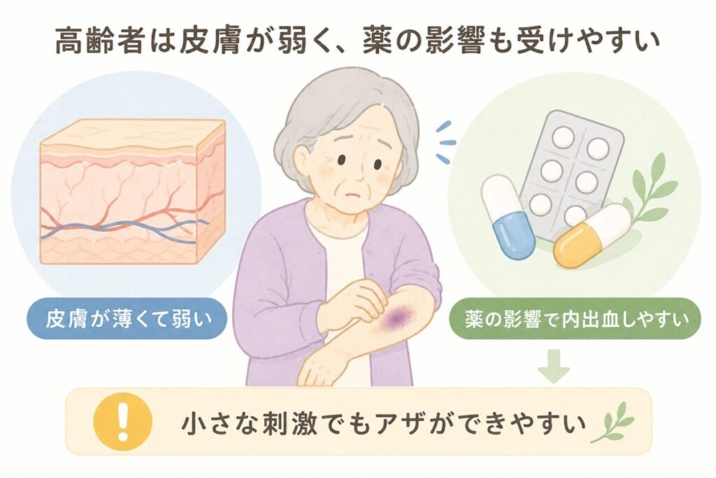 皮膚が薄く弱くなった高齢者では、薬の影響も重なり、小さな刺激でもアザができやすいことを示したイラスト。