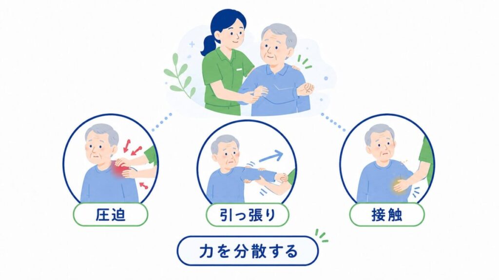 介助時の皮下出血を、圧迫・引っ張り・接触の3つの力のかかり方で整理し、力を分散する重要性を示した図。